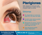 El pterigion o carnosidad de los ojos puede eliminarse. Llame al consultorio y agende su cita oftalmológica