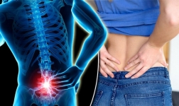 Atención oportuna en casos de lumbalgia o dolor de espalda baja