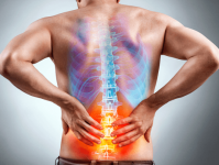 La lumbalgia o dolor de espalda baja es una molestia o dolor localizado en el área posterior del tronco por debajo de las costillas, hasta el margen inferior de la región glútea. Identificamos la causa y realizamos la rehabilitación del paciente